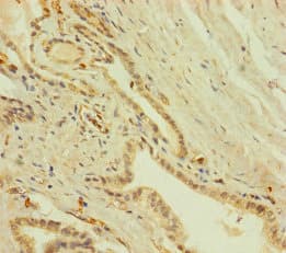 Polyclonal Rabbit anti-Human ZNF71 Antibody