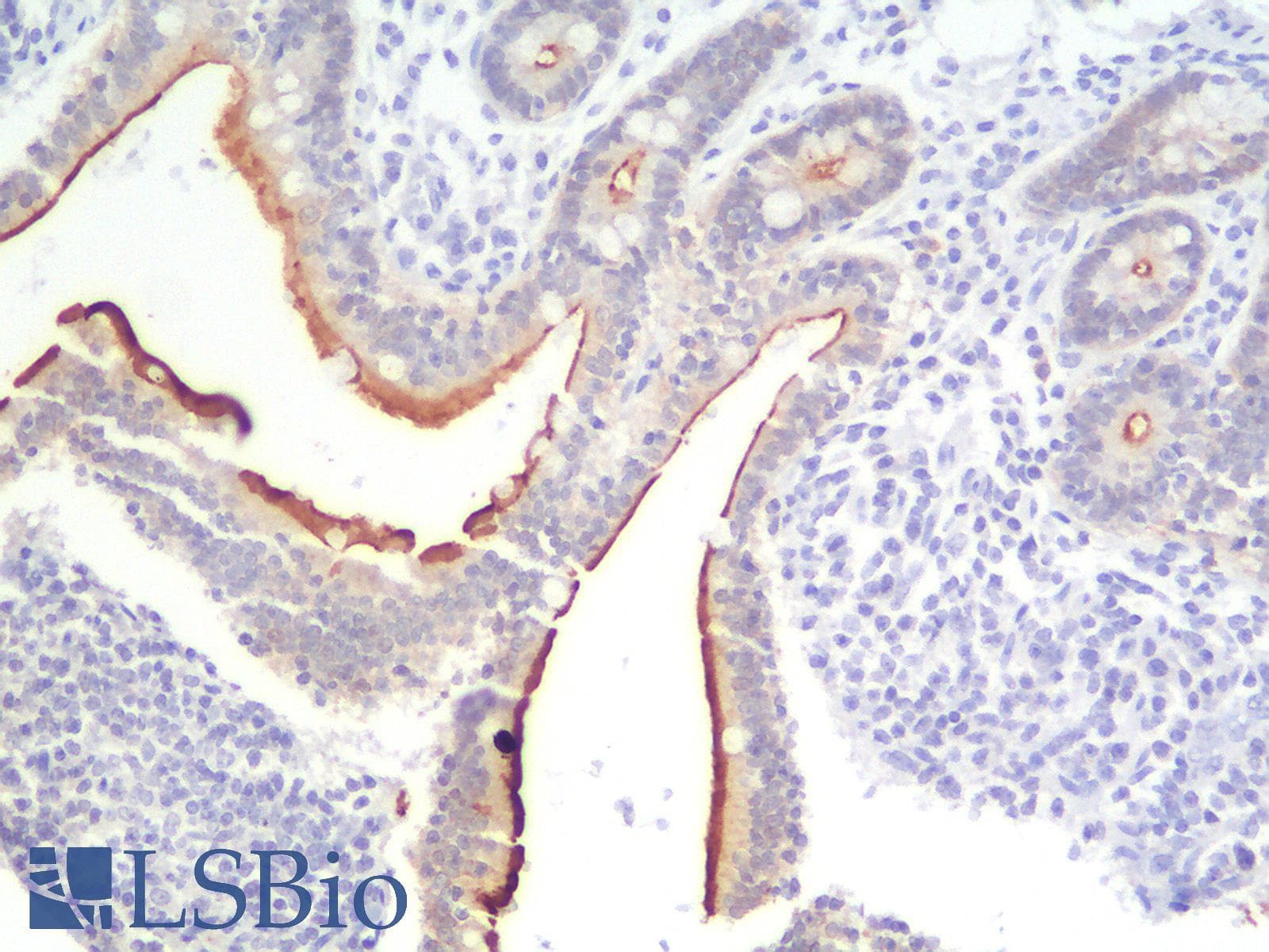 PathPlus™ Recombinant Monoclonal Rabbit anti-Human VIL1 / Villin Antibody (clone VIL1/2310R, aa179-311, IHC)