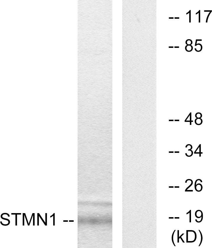 STMN1 / Stathmin / LAG Antibody (p15)