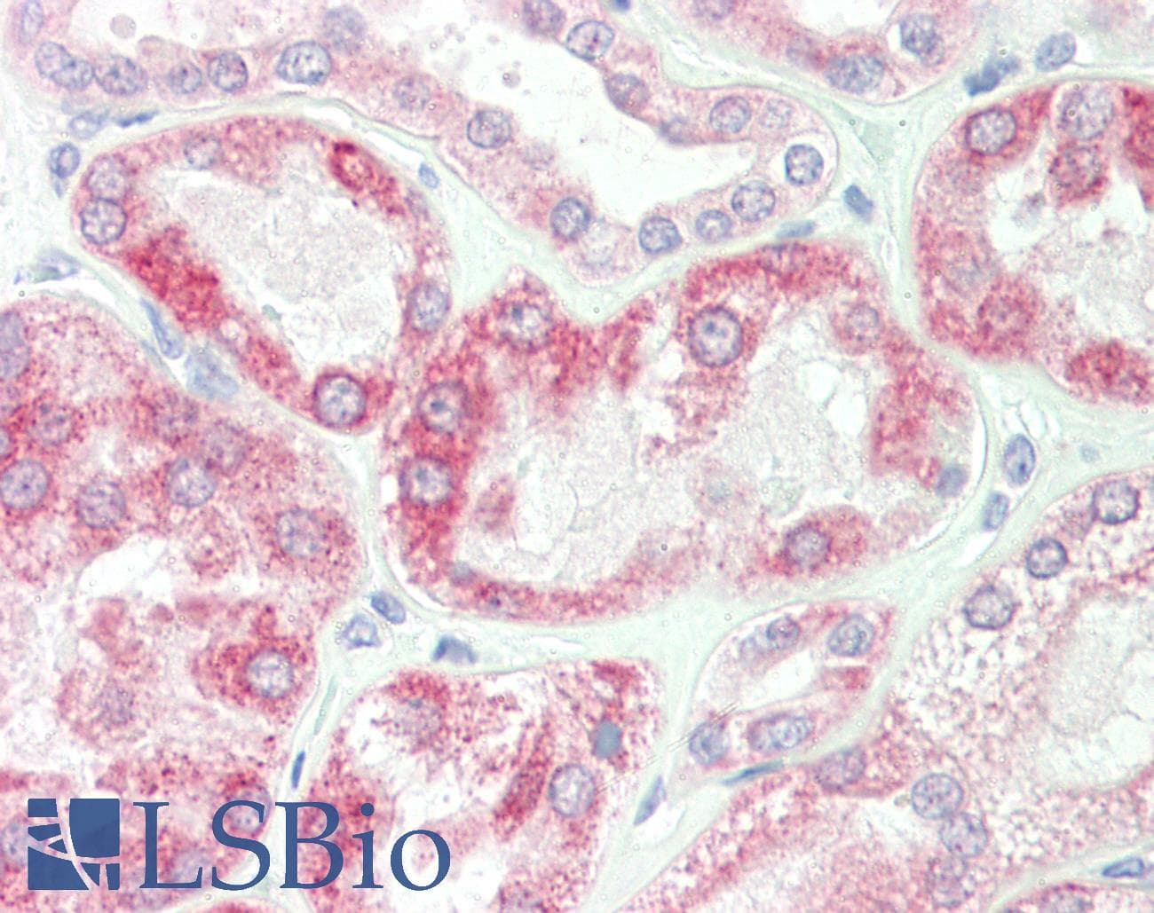 IHC-plus™ SPRY2 / Sprouty 2 Antibody (Internal)