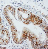 MMP8 Antibody (N-Terminus)