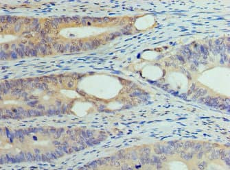 Polyclonal Rabbit anti-Human DNMT / DNMT1 Antibody (IHC, IF)