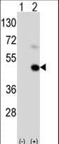 Polyclonal Rabbit anti-Human MAGEA9 Antibody (aa171-198, IHC, WB)