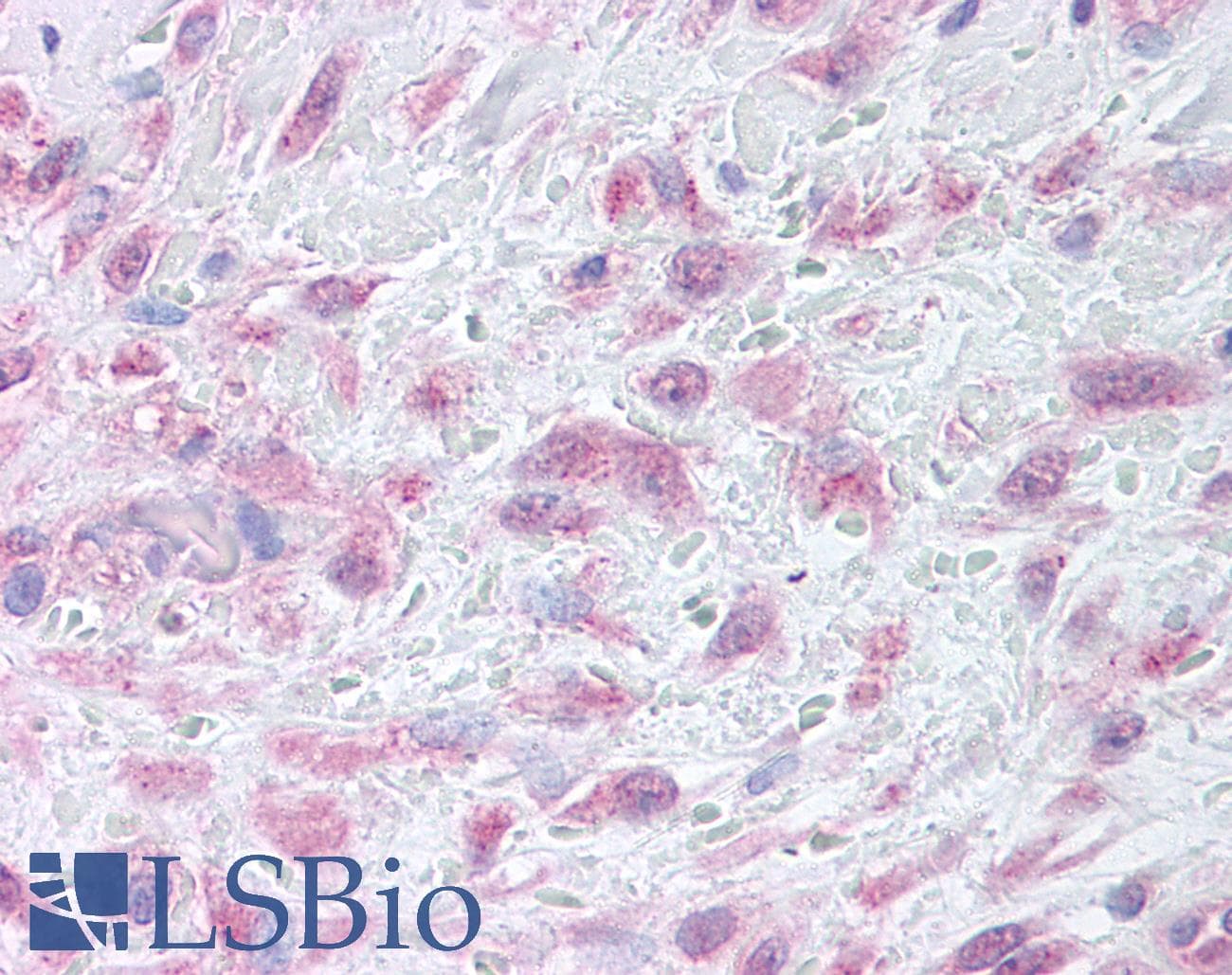 IHC-plus™ MMP9 / Gelatinase B Antibody (Internal)