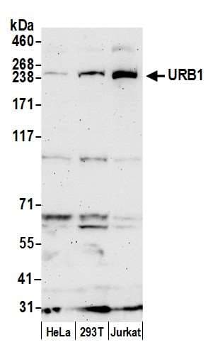 URB1 Antibody (aa2221-2271)
