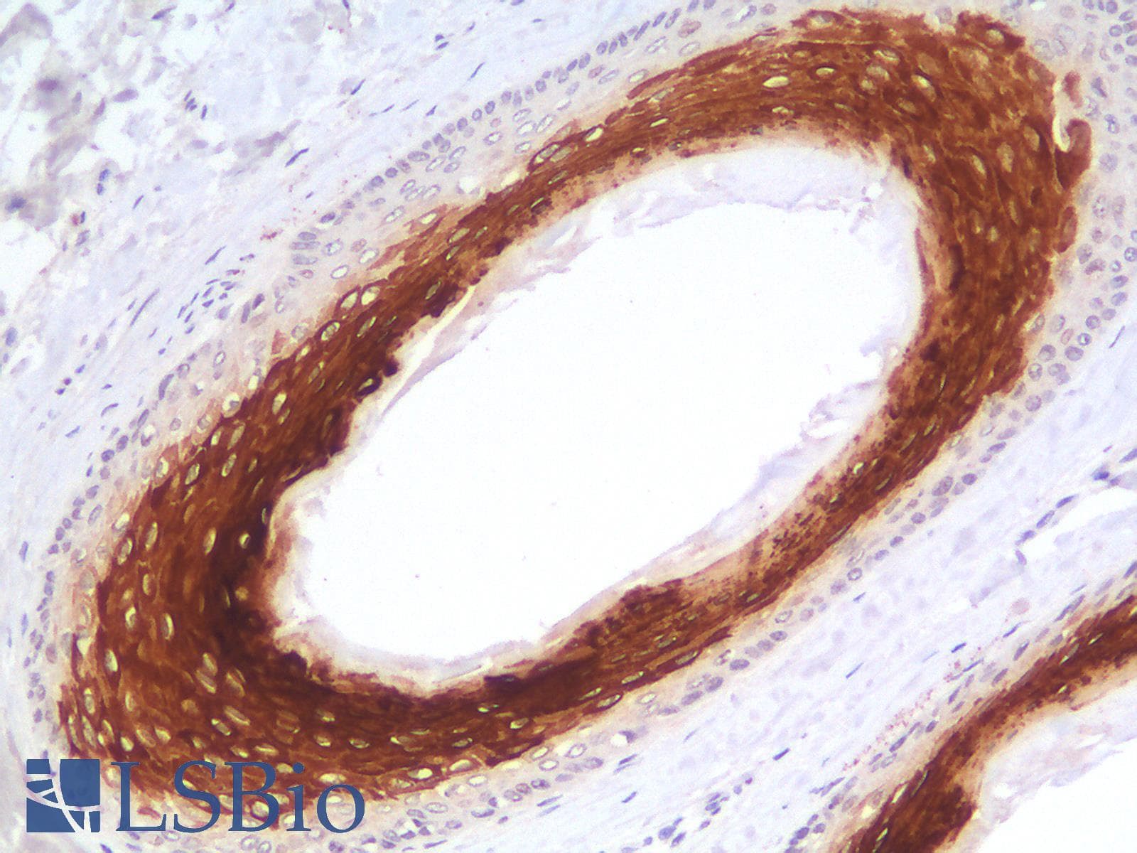 PathPlus™ KRT16 / CK16 / Cytokeratin 16 Antibody (C-Terminus, clone rKRT16/1714)