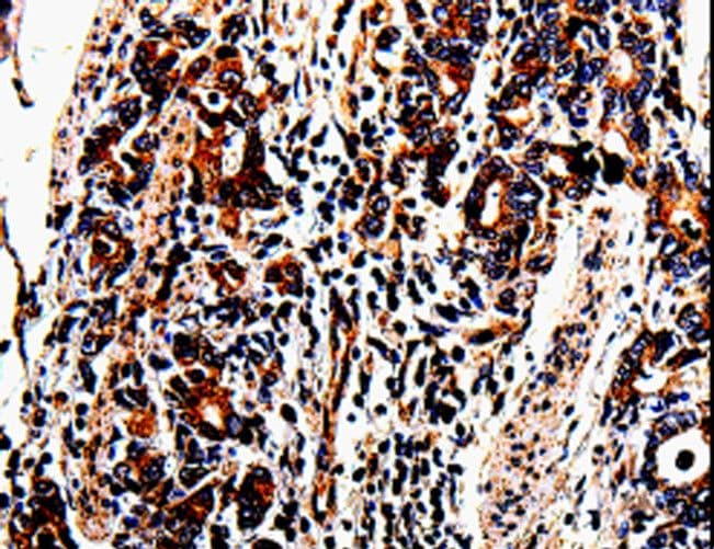 ACSBG2 Antibody