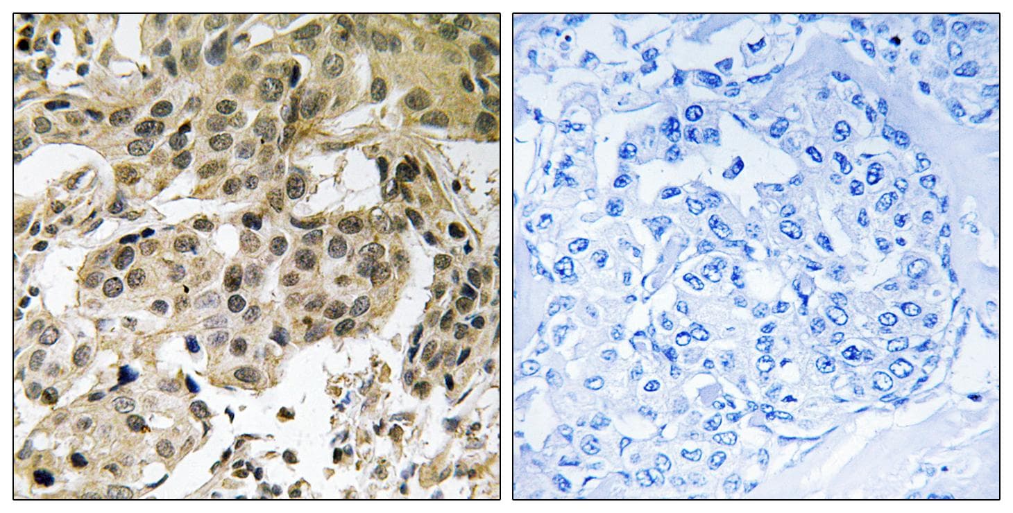 CBX5 / HP1 Alpha Antibody (phospho-Ser92)