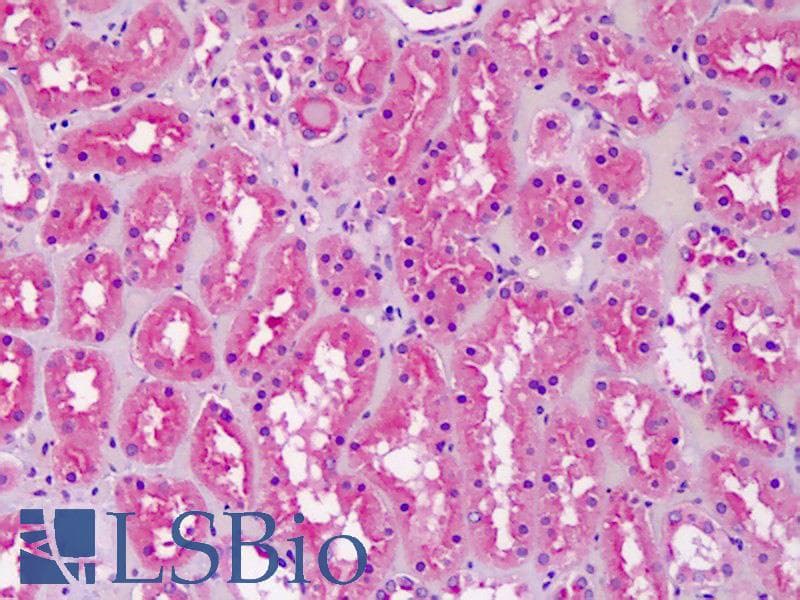 IHC-plus™ Cardiolipin Synthase / CRLS1 Antibody (aa161-174)