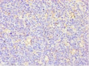 MSLN / Mesothelin Antibody (aa37-296)