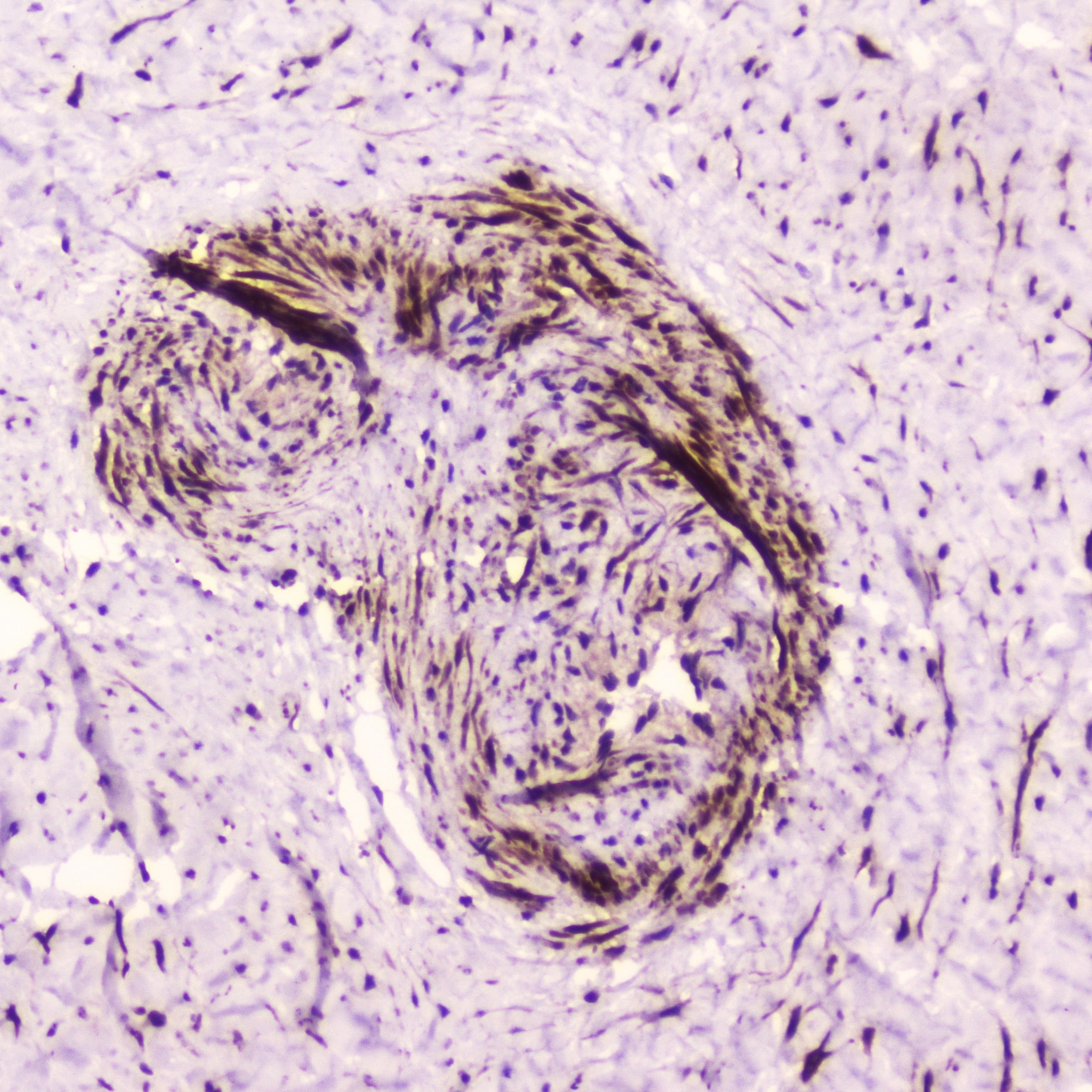 PDGFRB / PDGFR Beta Antibody