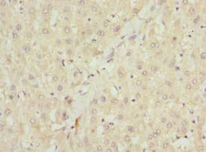 MALIN / NHLRC1 Antibody