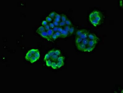 Polyclonal Rabbit anti-Human CENTD2 / ARAP1 Antibody (IHC, IF)