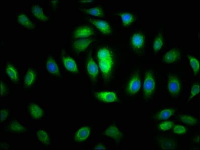 Polyclonal Rabbit anti-Human SACS / Sacsin Antibody (IHC)