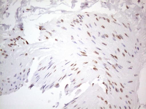 TLK2 Antibody (aa1-296, clone OTI2D10)