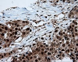 Monoclonal Mouse anti-Human ACLY / ATP Citrate Lyase Antibody (clone 3G8, Carrier-free, IHC, IF, WB)