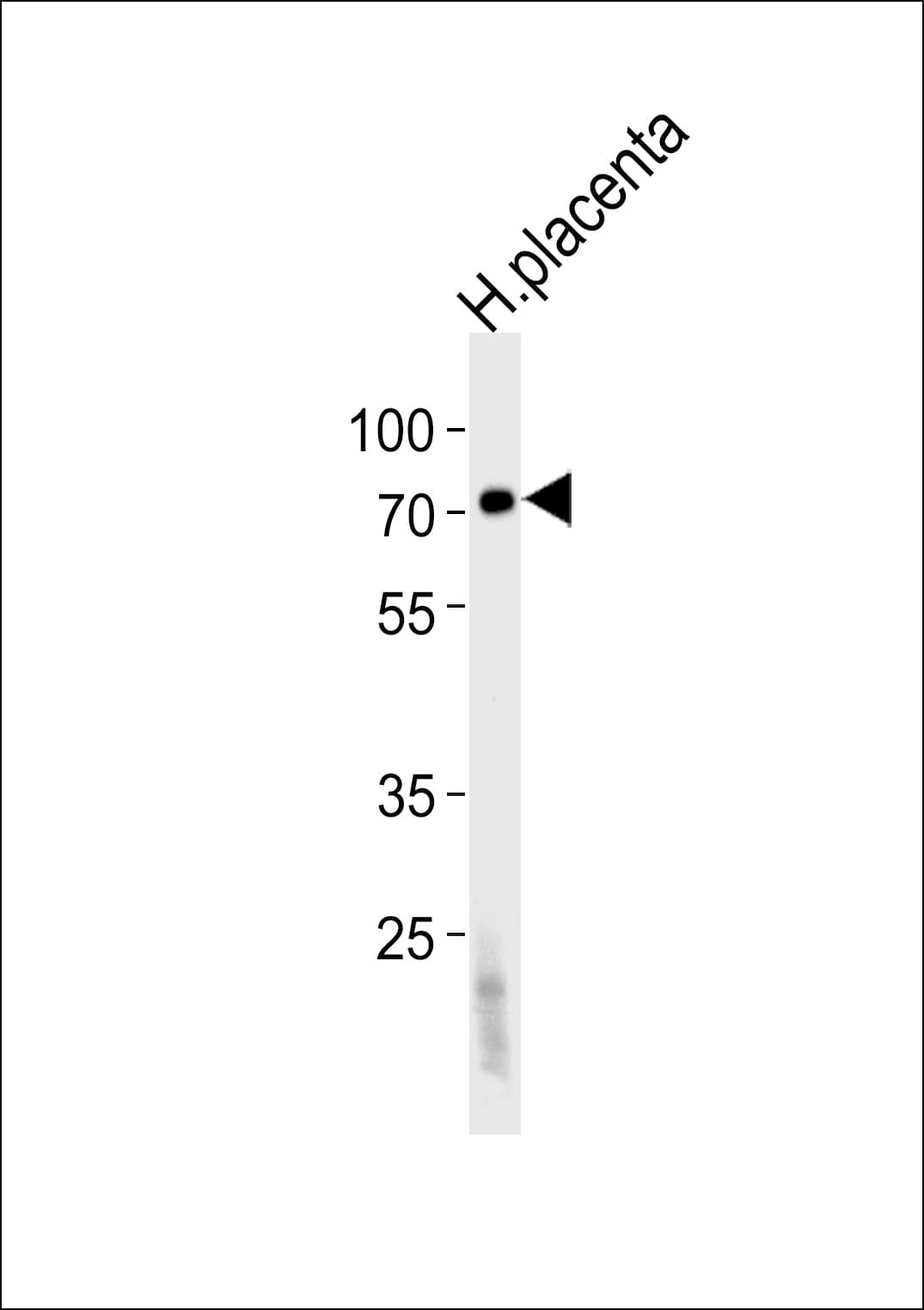 Polyclonal Rabbit anti-Human FUCA2 Antibody (aa138-167, IHC, WB)