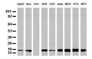 NME1 / NM23 Antibody (clone UMAB94)