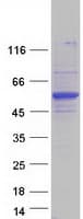 Human PICK1 Protein (Recombinant Myc-DDK (Flag))