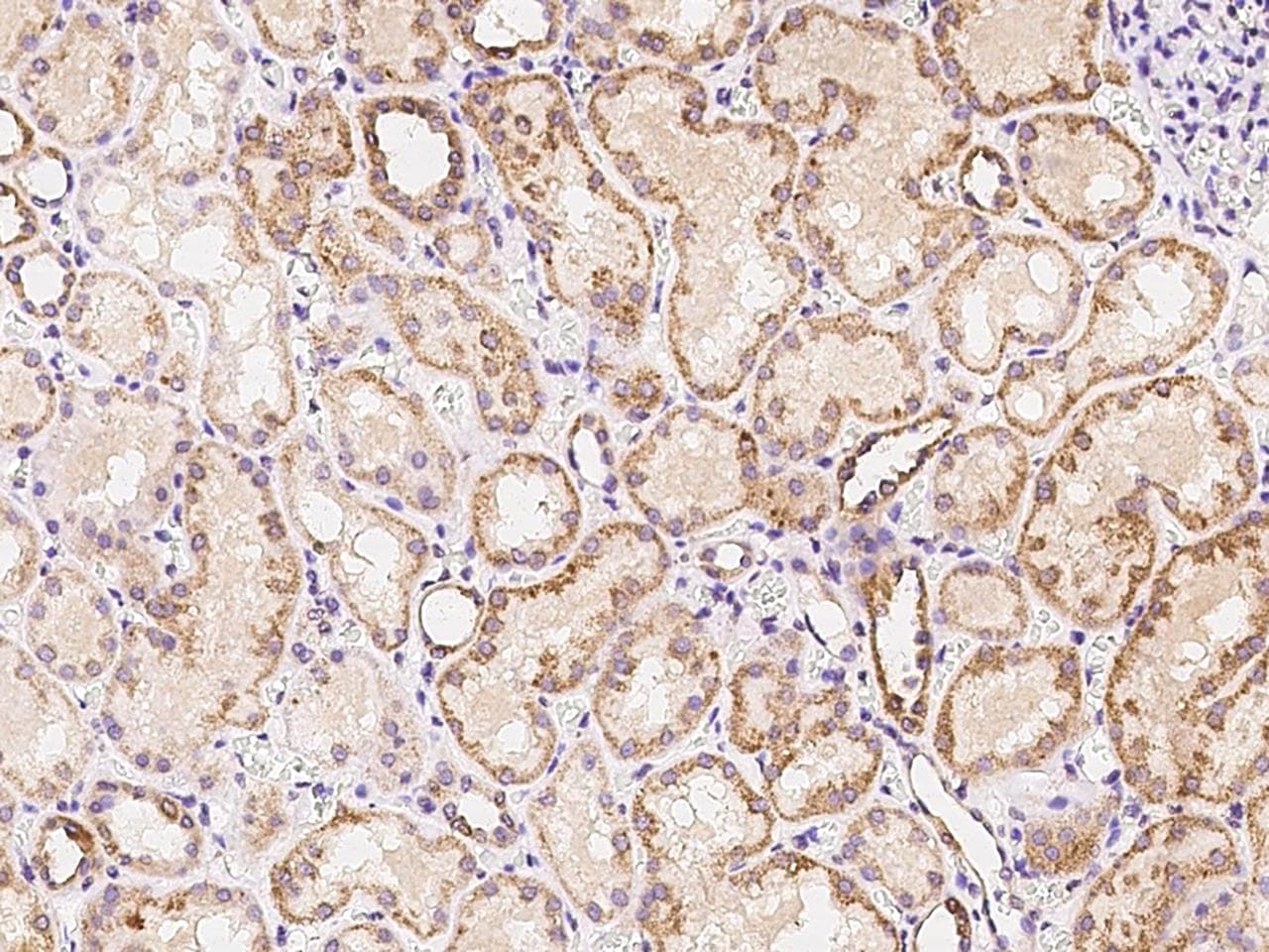 ADRA1D / Adrenoceptor alpha 1D Antibody