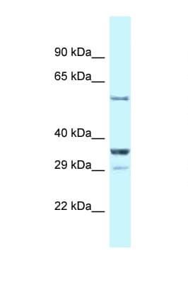 Polyclonal Rabbit anti-Mouse CBLL1 / HAKAI Antibody (aa413-462, WB)