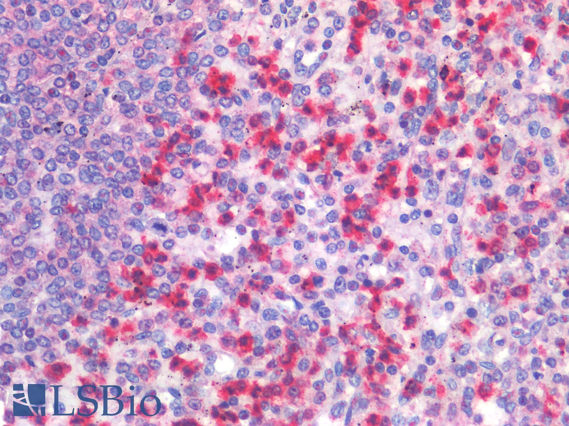 IHC-plus™ FPR1 / FPR Antibody (aa155-204)
