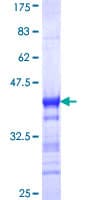 Human NRIP1 / RIP140 Protein (Recombinant GST, N-terminus)