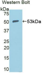 NCL / Nucleolin Antibody (aa388-569)