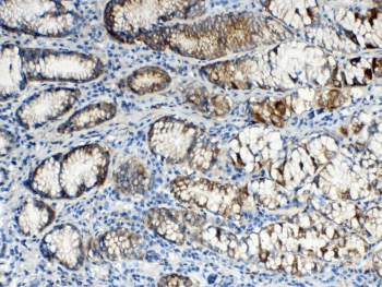 ALDH1A3 Antibody