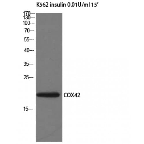 Polyclonal Rabbit anti-Human COX4I2 Antibody (1-80 aa, Internal, IHC, IF, WB)