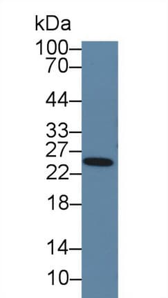 PRL / Prolactin Antibody (aa30-226, Cy3)