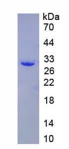 Human KPNA1 / Importin Alpha 5 Protein (Recombinant 6His, N-terminus)