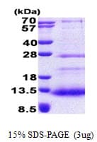 Human SPINK7 / ECRG2 Protein (Recombinant His)