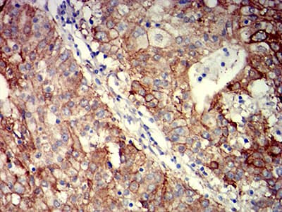 ITGB4 / Integrin Beta 4 Antibody (clone 1D6B4)