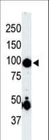 Polyclonal Rabbit anti-Human GCK / Germinal Center Kinase Antibody (aa288-319, IHC, WB)
