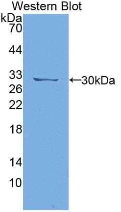 PTPRJ / CD148 Antibody (aa1033-1277)
