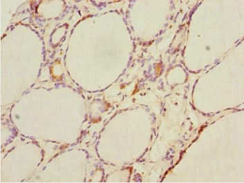 Polyclonal Rabbit anti-Human DTX2 Antibody (IHC)