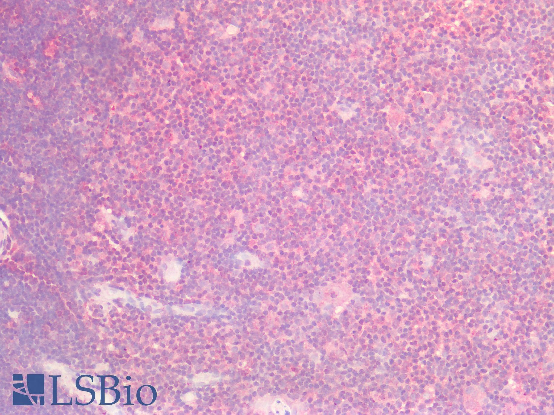 PathPlus™ Polyclonal Goat anti-Human SOX9 Antibody (aa248-259, IHC)