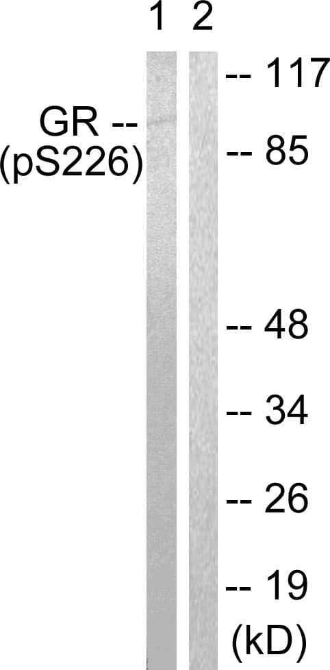NR3C1/Glucocorticoid Receptor Antibody (phospho-Ser226)