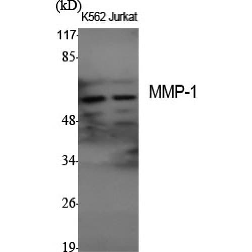 MMP1 Antibody (380-460 aa, C-terminal)