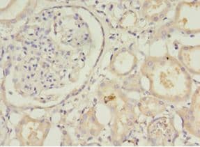 Amisyn / STXBP6 Antibody (aa2-210)