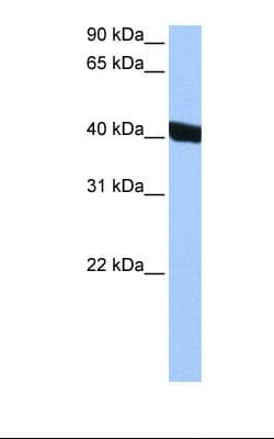 CHI3L1 / YKL-40 Antibody (aa198-247)