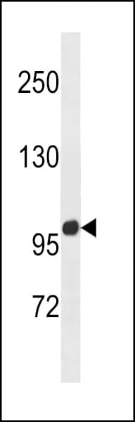 Polyclonal Rabbit anti-Human ZNF865 Antibody (aa1015-1042, WB)