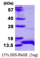 Human HOPX / HOP Protein (Recombinant His)
