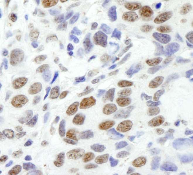 EWSR1 / EWS Antibody (aa100-150)