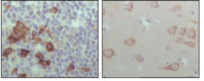 EPHB6 / EPH Receptor B6 Antibody (clone 2A6B9)