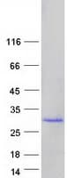 Human FKBP11 Protein (Recombinant Myc-DDK (Flag))