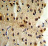 CLIP1 / CLIP-170 Antibody (aa228-254)
