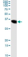 NNMT Antibody (clone 2F2)