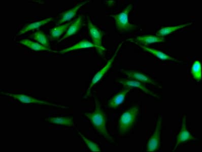 HSET / KIFC1 Antibody